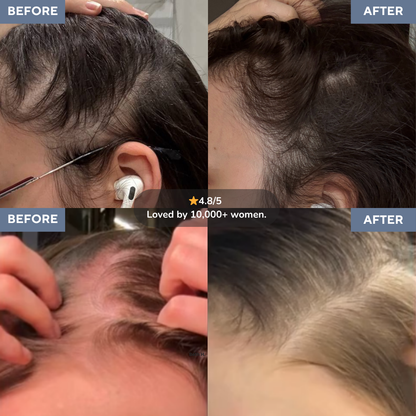 Rosemary Hair Growth Roll-On