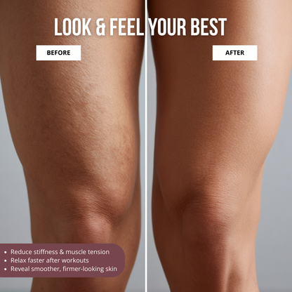 Sprynza™ Anti-Cellulite Roller