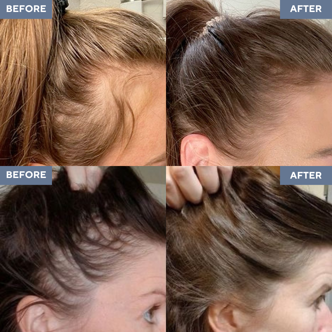 Rosemary Hair Growth Roll-On